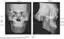Fig. 14 - METHOD FOR GENERATING DENTAL REGISTRATION DATA