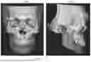 Fig. 16 - METHOD FOR GENERATING DENTAL REGISTRATION DATA