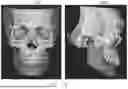 Fig. 17 - METHOD FOR GENERATING DENTAL REGISTRATION DATA