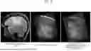 Fig. 15 - SYSTEMS AND METHODS FOR REAL-TIME MULTIMODAL DEFORMABLE IMAGE REGISTRATION FOR IMAGE-GUIDED INTERVENTIONS