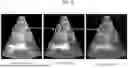 Fig. 16 - SYSTEMS AND METHODS FOR REAL-TIME MULTIMODAL DEFORMABLE IMAGE REGISTRATION FOR IMAGE-GUIDED INTERVENTIONS