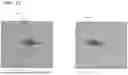 Fig. 14 - SYSTEMS, DEVICES, AND METHODS FOR IMAGING AND DEPTH MEASUREMENT