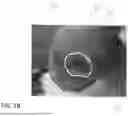 Fig. 17 - SYSTEMS, DEVICES, AND METHODS FOR IMAGING AND DEPTH MEASUREMENT