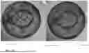 Fig. 23 - SYSTEMS, DEVICES, AND METHODS FOR IMAGING AND DEPTH MEASUREMENT