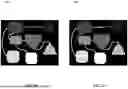 Fig. 13 - SYSTEM AND METHOD FOR VISION-ASSISTED APPROACH FOR GRAPH STRUCTURE EXTRACTION IN VARIOUS TYPES OF DOCUMENTS