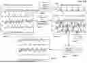 Fig. 23 - METHOD FOR SELECTING HIGH-QUALITY DATA FROM BIOLOGICAL SIGNALS FROM DIFFERENT MONITORING DEVICES
