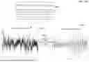 Fig. 26 - METHOD FOR SELECTING HIGH-QUALITY DATA FROM BIOLOGICAL SIGNALS FROM DIFFERENT MONITORING DEVICES