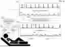 Fig. 32 - METHOD FOR SELECTING HIGH-QUALITY DATA FROM BIOLOGICAL SIGNALS FROM DIFFERENT MONITORING DEVICES