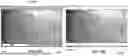 Fig. 14 - USE OF CATH LAB IMAGES FOR TREATMENT PLANNING