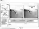 Fig. 16 - USE OF CATH LAB IMAGES FOR TREATMENT PLANNING
