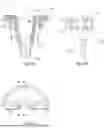 Fig. 06 - Cable Grommet
