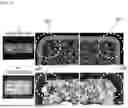 Fig. 18 - SOFT MAGNETIC POWDER AND INDUCTOR