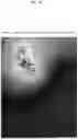 Fig. 18 - MAGNETIZED INDUCTIVELY COUPLED PLASMA PROCESSING DEVICE