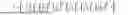 Fig. 114 - Methods and Apparatuses for Codebook Restriction for Type-II Feedback Reporting and Higher Layer Configuration and Reporting for Linear Combination Codebook in a Wireless Communications Network