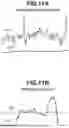 Fig. 12 - FOCUS CONTROL APPARATUS, IMAGING APPARATUS, AND FOCUS CONTROL METHOD