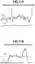 Fig. 12 - FOCUS CONTROL APPARATUS, IMAGING APPARATUS, AND FOCUS CONTROL METHOD