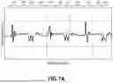 Fig. 13 - Methods of Operating a Pulse Width Modulation Valve, and Related Agricultural Machines and Monitoring Systems