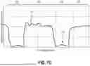 Fig. 15 - Methods of Operating a Pulse Width Modulation Valve, and Related Agricultural Machines and Monitoring Systems
