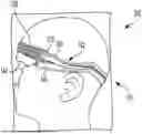 Fig. 01 - FIT SYSTEMS FOR HELMETS
