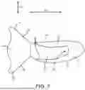 Fig. 04 - ARTICLE OF FOOTWEAR HAVING A KNITTED COMPONENT WITH A FOREFOOT PORTION AND A HEEL PORTION