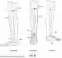 Fig. 07 - POWERED FOOTWEAR ATTACHMENT