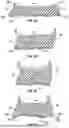 Fig. 20 - SOLE STRUCTURE WITH MIDSOLE PROTRUSIONS AND ARCED PROFILE FOR FORWARD MOMENTUM