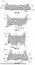 Fig. 30 - SOLE STRUCTURE WITH MIDSOLE PROTRUSIONS AND ARCED PROFILE FOR FORWARD MOMENTUM