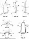 Fig. 04 - MECHANICALLY COUPLED NAIL TIP