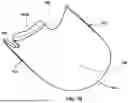 Fig. 09 - MECHANICALLY COUPLED NAIL TIP