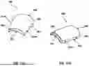 Fig. 17 - MECHANICALLY COUPLED NAIL TIP