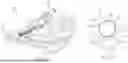 Fig. 03 - MEDICAL DEVICE SHAFTS, COMPONENTS, ASSEMBLIES, AND RELATED METHODS OF MANUFACTURING AND/OR ASSEMBLING TO PREVENT LEAKS