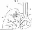 Fig. 13 - ENDOSCOPE