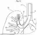 Fig. 15 - ENDOSCOPE