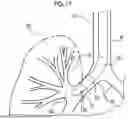Fig. 17 - ENDOSCOPE
