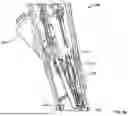 Fig. 04 - SYSTEMS AND METHODS FOR VARYING STIFFNESS OF AN ENDOSCOPIC INSERTION TUBE