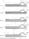Fig. 07 - IMAGING SYSTEM INCLUDES IMAGING PROBE AND DELIVERY DEVICES