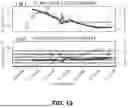 Fig. 15 - APPARATUS FOR DETECTING LIMB ISCHEMIA AND METHOD OF USE THEREOF