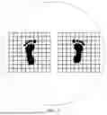 Fig. 03 - SCOLIOSIS RECOGNITION SYSTEM AND METHOD BASED ON ACTIVE MILLIMETER WAVE IMAGING TECHNOLOGY