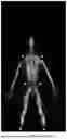 Fig. 04 - SCOLIOSIS RECOGNITION SYSTEM AND METHOD BASED ON ACTIVE MILLIMETER WAVE IMAGING TECHNOLOGY