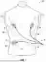 Fig. 02 - LEAD SET WIRE MANAGEMENT