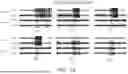 Fig. 15 - SYSTEM AND METHODS FOR PROPOSING DETECTION PARAMETERS FOR DETECTING EPILEPTIFORM ACTIVITY