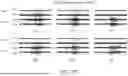 Fig. 16 - SYSTEM AND METHODS FOR PROPOSING DETECTION PARAMETERS FOR DETECTING EPILEPTIFORM ACTIVITY