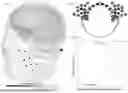 Fig. 08 - SYSTEM AND METHOD OF DETECTING ELECTROPHYSIOLOGICAL EVENTS IN A SUBJECT