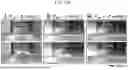 Fig. 17 - Non-Destructive Pressure-Assisted Tissue Stiffness Measurement Apparatus