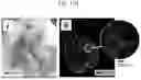 Fig. 19 - Non-Destructive Pressure-Assisted Tissue Stiffness Measurement Apparatus