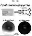 Fig. 23 - Non-Destructive Pressure-Assisted Tissue Stiffness Measurement Apparatus
