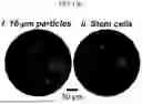 Fig. 27 - Non-Destructive Pressure-Assisted Tissue Stiffness Measurement Apparatus