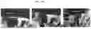 Fig. 31 - Non-Destructive Pressure-Assisted Tissue Stiffness Measurement Apparatus