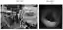 Fig. 32 - Non-Destructive Pressure-Assisted Tissue Stiffness Measurement Apparatus