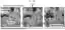 Fig. 40 - Non-Destructive Pressure-Assisted Tissue Stiffness Measurement Apparatus